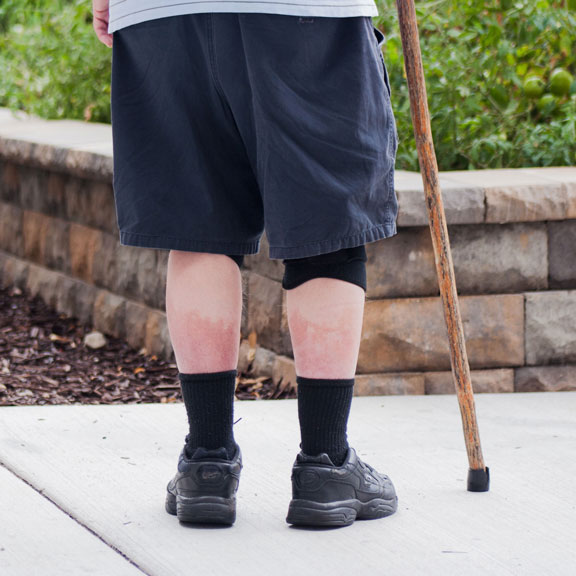 Mark, Food & Care Coalition patron